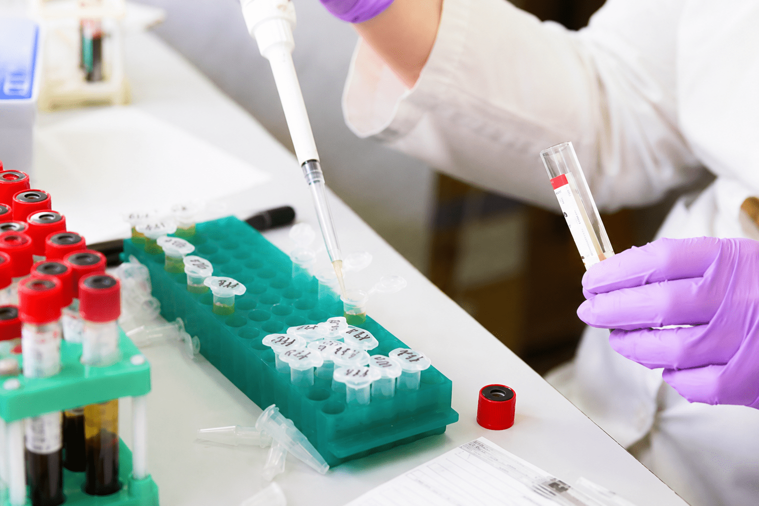 Scientifique réalisant une expérience en laboratoire avec une pipette et des tubes d’échantillons.